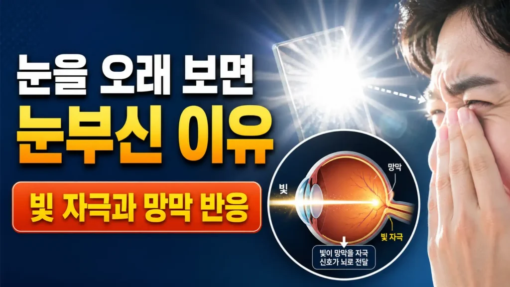눈을 오래 보면 눈부신 이유
